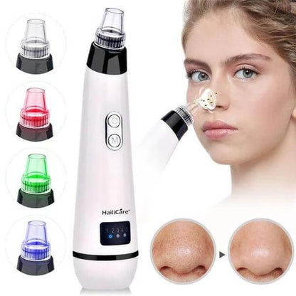 Three-color light-absorbing blackhead artifact